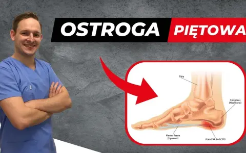 Ostroga piętowa: 5 ćwiczeń, które pokonają ból pięty!