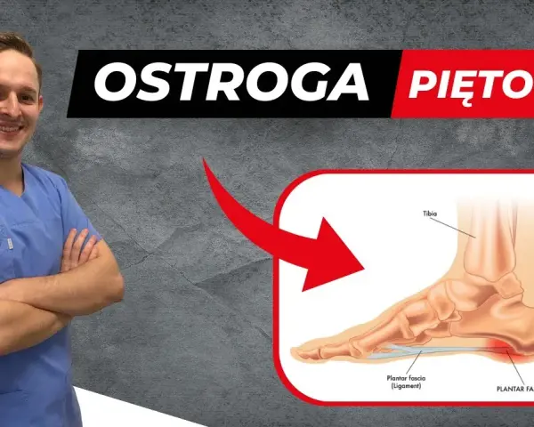 Ostroga piętowa: 5 ćwiczeń, które pokonają ból pięty!